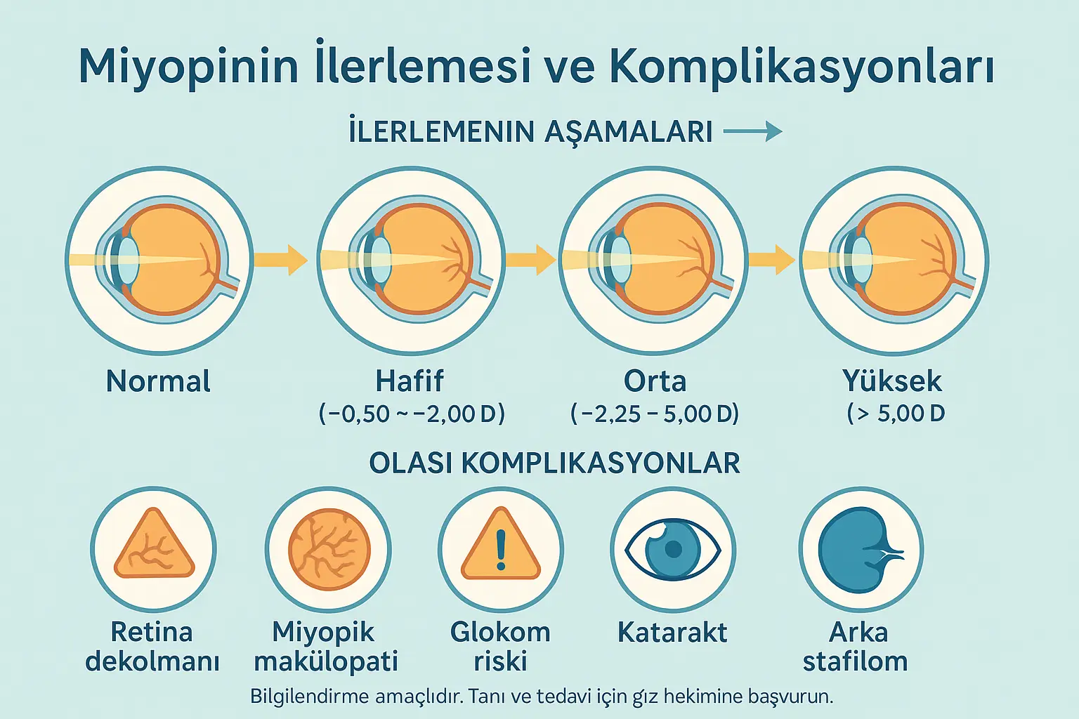 Miyopun İlerlemesi ve Komplikasyonları
